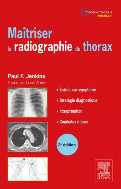 Maîtriser la radiographie du thorax, 2 ème édition